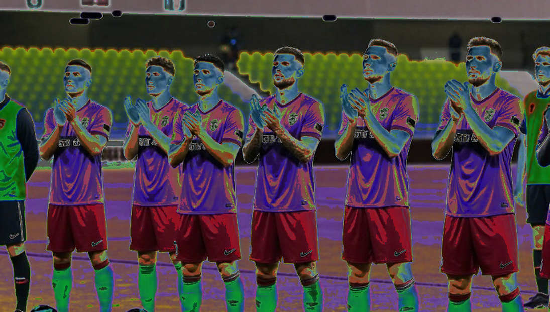 V.League 1 giữa kỳ chuyển nhượng: Cấu trúc hợp đồng mới là câu chuyện thật V.League 1 giữa kỳ chuyển nhượng: Cấu trúc hợp đồng mới là câu chuyện thật